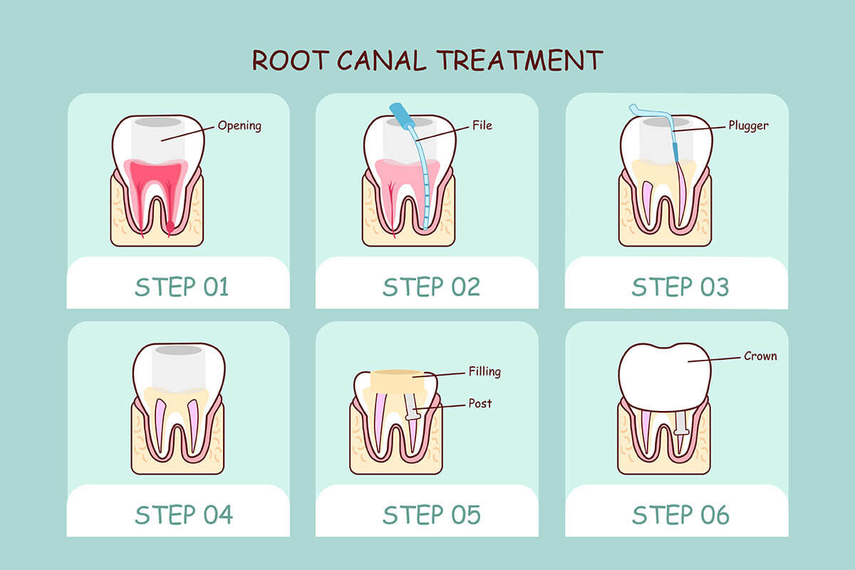 Dentist TX