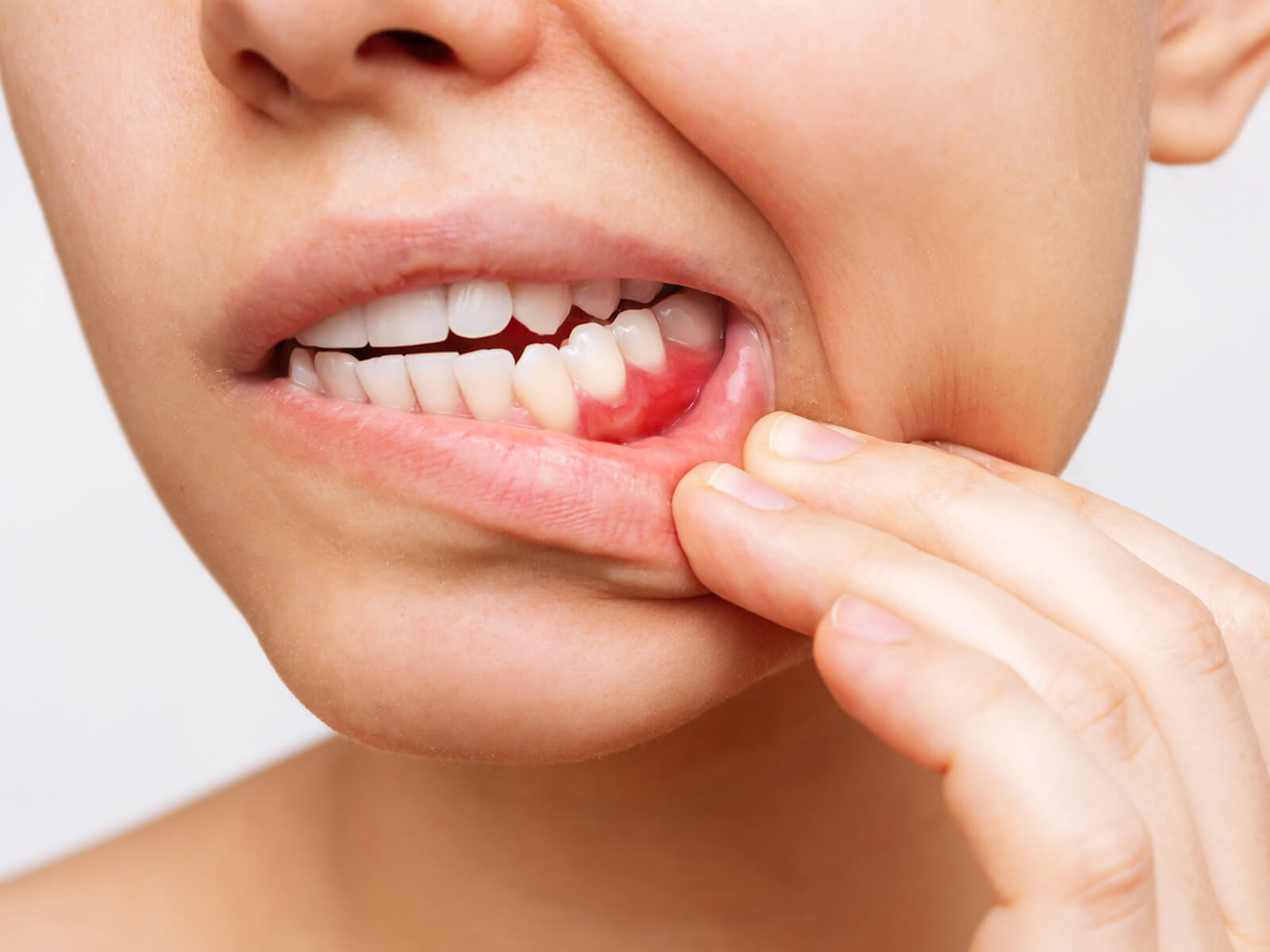Why Do You Have A Bump on Your Gums?