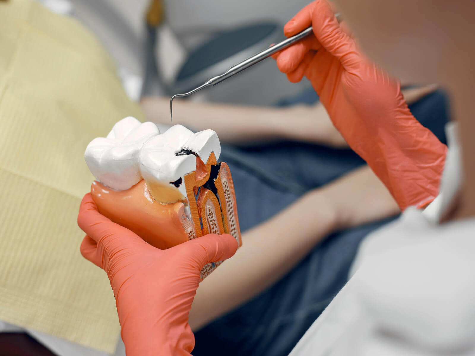 The Role Of Cavity Fillings In Dental Care