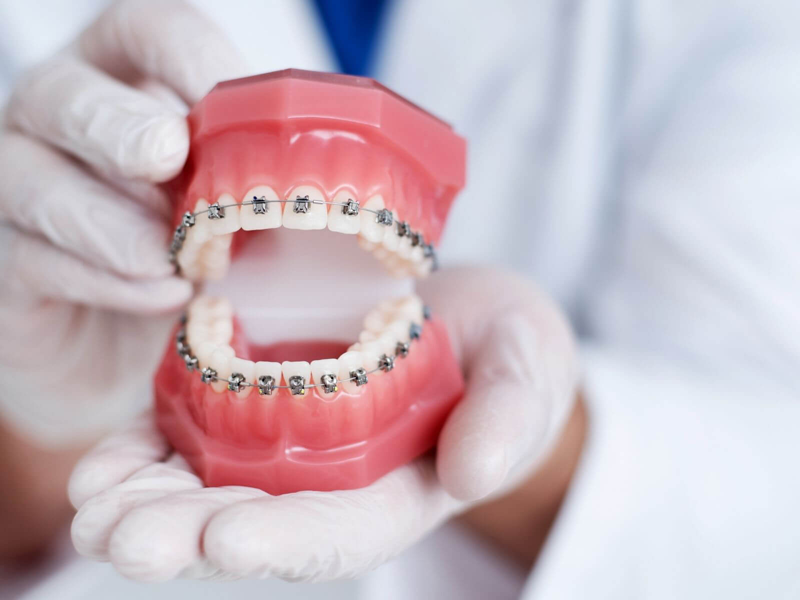 Should I Consider Invisalign Instead of Braces?