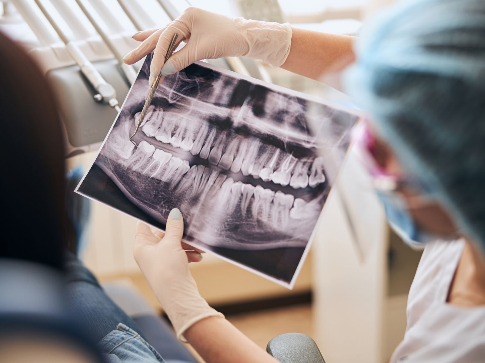 What Should Dental X-Rays Cost? A Realistic Price Guide