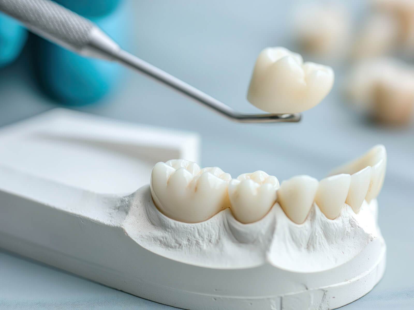 Dental Crown vs Filling: What’s the Difference?