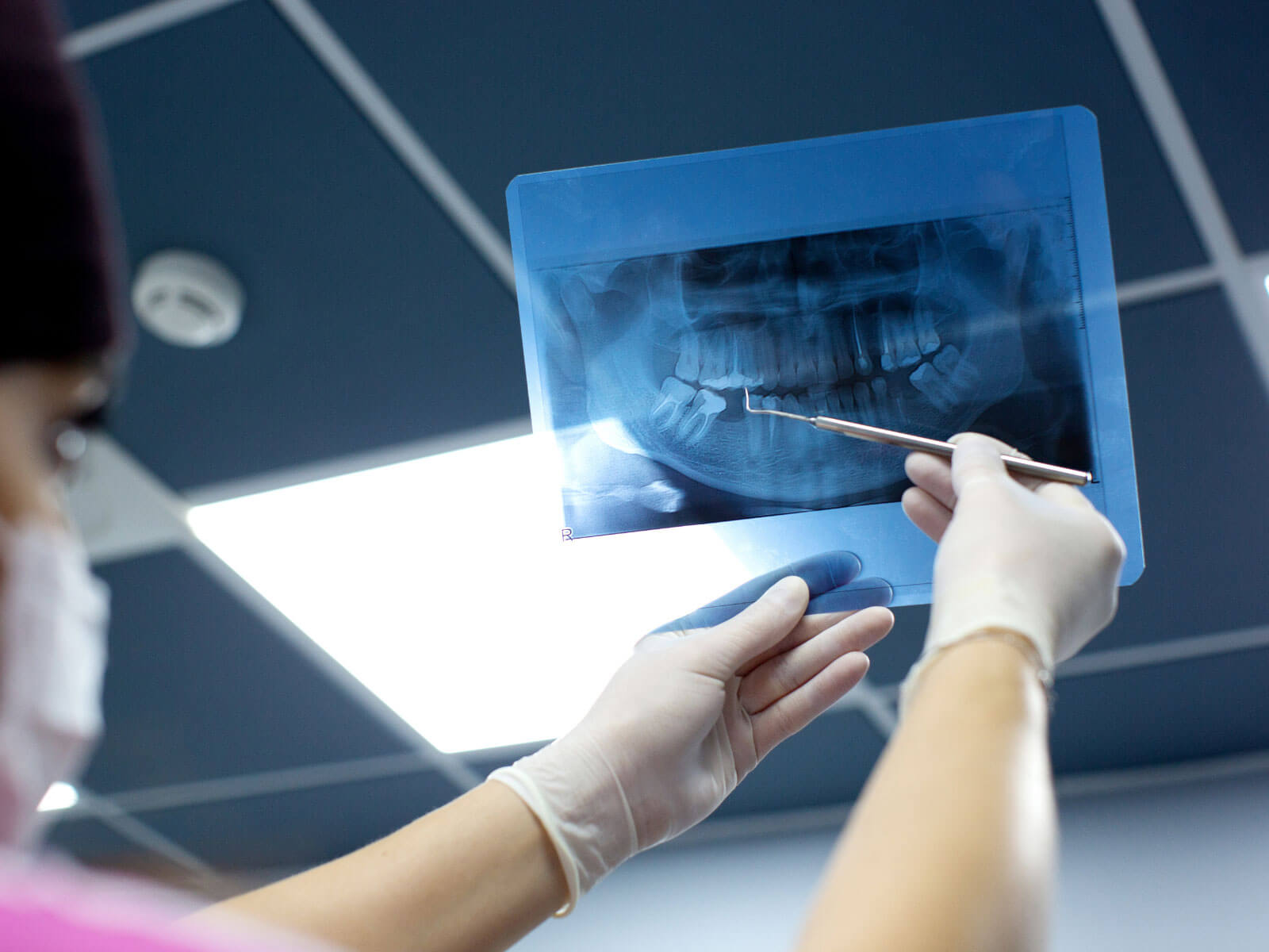 Panoramic Dental X-Ray: What It Is, How It Works, and What It Shows